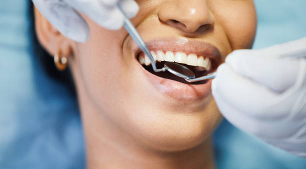 Best Emergency Treatment for Dental Infections or Abscesses in Crystal Springs, MS